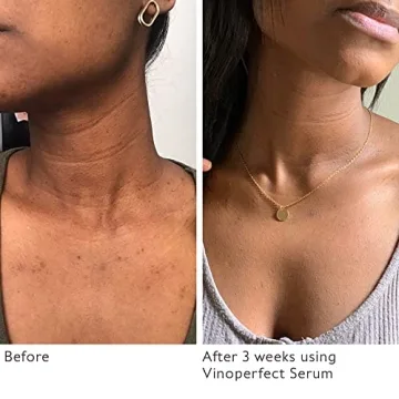 Luxurious Caudalie Holiday Gift Set for Radiance