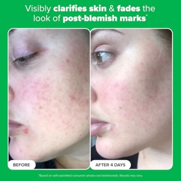 Paula's Choice 10% Azelaic Acid Booster for Clear Skin