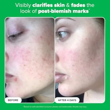Paula's Choice 10% Azelaic Acid Booster for Clear Skin