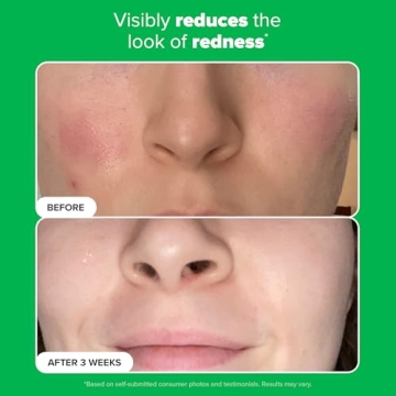 Paula's Choice 10% Azelaic Acid Booster for Clear Skin