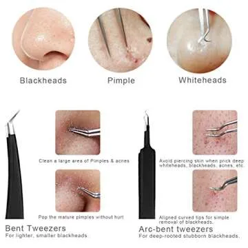 XOOL Precision Tweezers Set – Premium 10 Pcs Kit