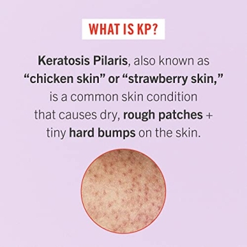 First Aid Beauty - Bye Bye Bumps Kit: KP Bump Eraser Body Scrub, 4 oz, Smoothing Lotion, 1oz, and Ingrown Hair Pads, 28 Pads, Deep Moisture Exfoliating Skin Treatment Set with BHA & AHA, 3ct