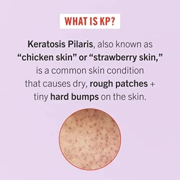 First Aid Beauty - Bye Bye Bumps Kit: KP Bump Eraser Body Scrub, 4 oz, Smoothing Lotion, 1oz, and Ingrown Hair Pads, 28 Pads, Deep Moisture Exfoliating Skin Treatment Set with BHA & AHA, 3ct