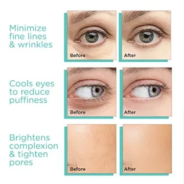 MonétBeauty Ice Globes for Skin Radiance & Relaxation