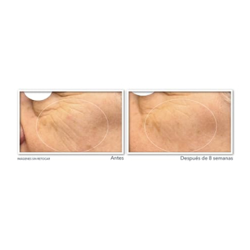 RoC Multi Correxion Glow Vitamin C Serum Capsules 30 Count