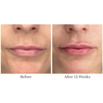 City Beauty City Lips Night Oil for Plump Hydration