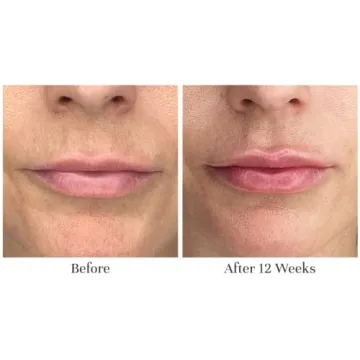 City Beauty City Lips Night Oil for Plump Hydration