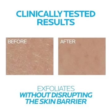 La Roche-Posay Lipikar Urea 10% Smoothing Lotion for Dry Skin