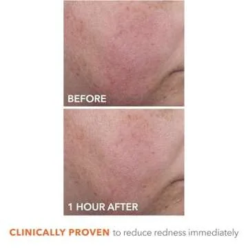 Dr Dennis Gross DermInfusions Blur + Repair Cream, Instantly Blurs Fine Lines, Smooths Skin with Satin-Matte Finish, Visibly Plumps & Firms, Reduces Redness, and Improves Skin Elasticity, 1.7 Fl Oz