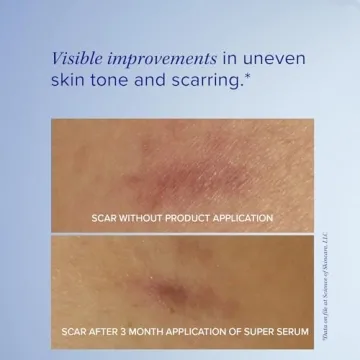 iS CLINICAL Super Serum Advance+, Anti-Aging Vitamin C Face Serum, reduces scaring and fine stretch marks, 1 Fl Oz