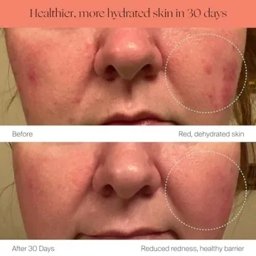 Canopy Humidifier Plus Large Room Humidifier 5.5L 36HR