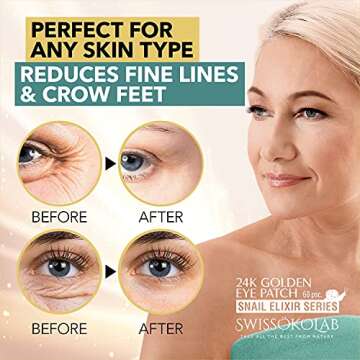 SWISSÖKOLAB Under Eye Patches For Puffy Eyes 24k Gold Eye Mask Dark Circles And Puffiness Collagen Eye Gel Pads Moisturizing & Reducing Wrinkles Anti-Aging Hyaluronic Acid (Snail Series)