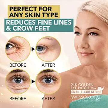 SWISSÖKOLAB Under Eye Patches For Puffy Eyes 24k Gold Eye Mask Dark Circles And Puffiness Collagen Eye Gel Pads Moisturizing & Reducing Wrinkles Anti-Aging Hyaluronic Acid (Snail Series)