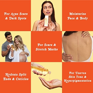 Bio-Oil Moisturizer for Scars Stretchmarks All Skin Types