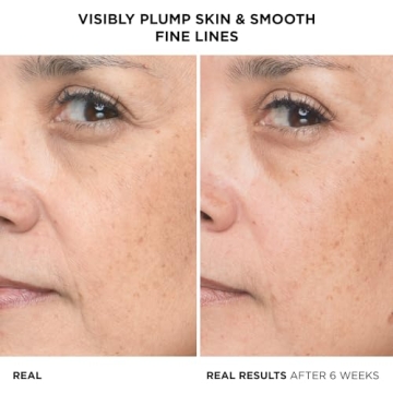 Hydrating Hyaluronic Acid Serum for Smooth Skin