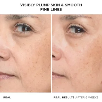 Hydrating Hyaluronic Acid Serum for Smooth Skin