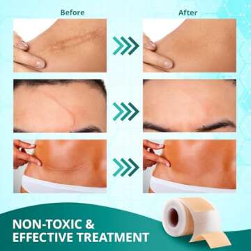 Silicone Scar Sheets,Silicone Scar Tape(1.6"x 60" Roll-1.5M), Reusable and Effective Scar Removal Sh...