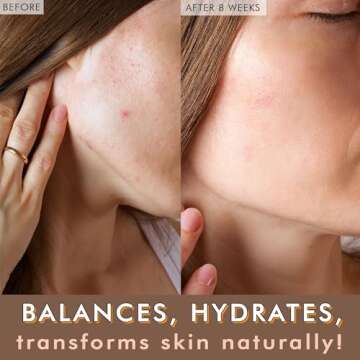 USDA Organic Face Oil - USA Made with Natural Ingredients, Anti Aging Formula for Acne-Prone & Oily ...