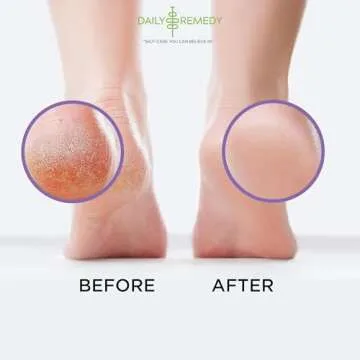 Calming Lavender Foot Soak with Epsom Salt, Made in USA, Foot Soak Soothes Sore Tired Feet, Athletes Foot, Stubborn Foot Odor, Softens Calluses & Helps Treat Toenail, 16 oz 1 lb