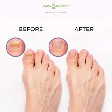 Calming Lavender Foot Soak with Epsom Salt, Made in USA, Foot Soak Soothes Sore Tired Feet, Athletes Foot, Stubborn Foot Odor, Softens Calluses & Helps Treat Toenail, 16 oz 1 lb