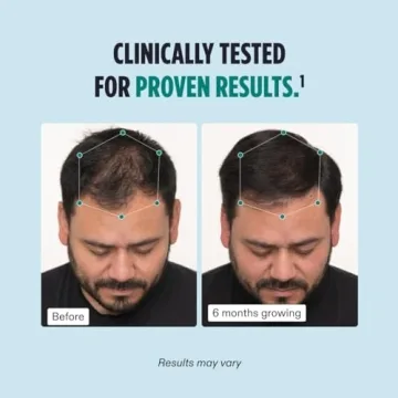 Nutrafol Men's Hair Growth Supplements for Thicker Hair