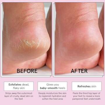 Award-Winning Grace & Stella Foot Peeling Mask for Soft Feet