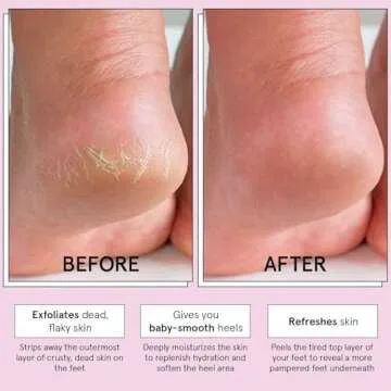 Award-Winning Grace & Stella Foot Peeling Mask for Soft Feet