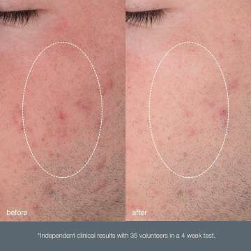 Dermalogica Daily Microfoliant Exfoliant Scrub Powder