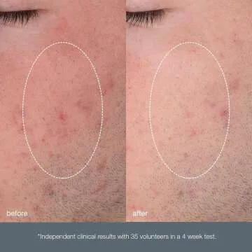 Dermalogica Daily Microfoliant Exfoliant Scrub Powder