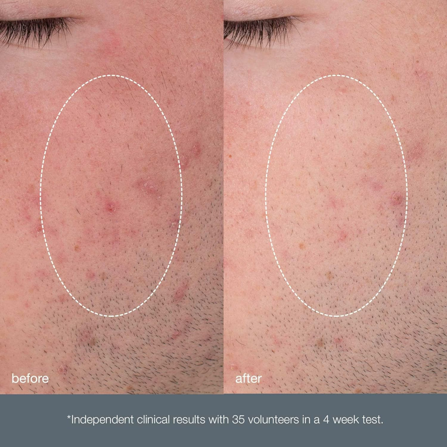 Dermalogica Daily Microfoliant Exfoliant Scrub Powder