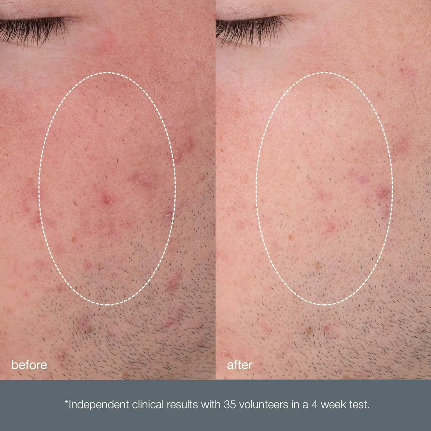 Dermalogica Daily Microfoliant Exfoliant Scrub Powder