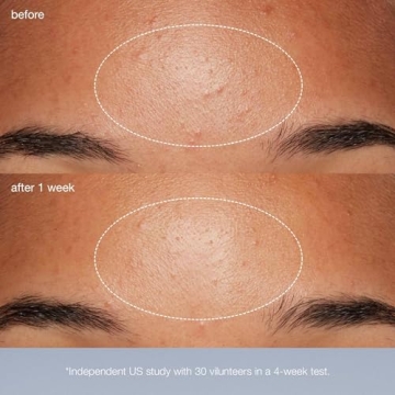 Dermalogica Daily Microfoliant Exfoliant Scrub for Brighter Skin