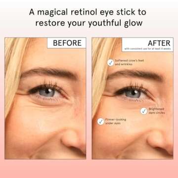 grace & stella Under Eye Brightener Balm Stick - Retinol & Caffeine Eye Cream with for Dark Circles, Puffiness, Wrinkles - Instantly Hydrate and Brighten Undereye Area - Vegan Skincare (0.13oz / 3.5g)