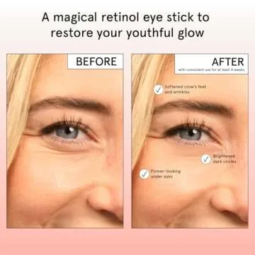 grace & stella Under Eye Brightener Balm Stick - Retinol & Caffeine Eye Cream with for Dark Circles, Puffiness, Wrinkles - Instantly Hydrate and Brighten Undereye Area - Vegan Skincare (0.13oz / 3.5g)