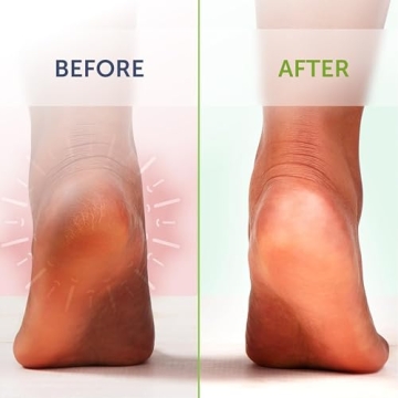 Tea Tree Oil Foot Soak - Soothe & Refresh Tired Feet