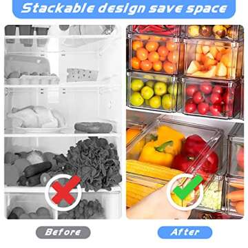 MDHAND Fridge Organizer - Refrigerator Organizer Bins, 10pcs Fridge Organizer and Storage Clear, Stackable Fridge Organizer Bins with Lid BPA Free Egg Organizer for Refrigerator