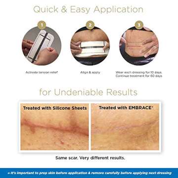 Embrace Active Scar Defense for New Scars Treatment