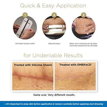 Embrace Active Scar Defense for New Scars Treatment