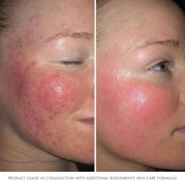 Bioelements Barrier Fix Daily Hydrator, 1.7 Fl Oz