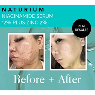 Naturium Niacinamide Serum 12% Plus Zinc - Revitalize Skin Naturally