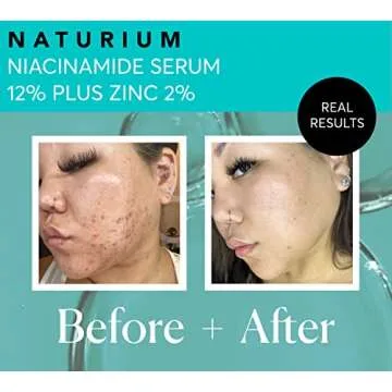 Naturium Niacinamide Serum 12% Plus Zinc - Revitalize Skin Naturally
