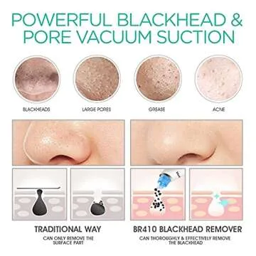VOYOR Blackhead Remover Electric Pore Vacuum for Clear Skin