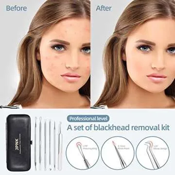JPNK Blackhead Remover Kit for Clear Skin