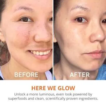 goPure Actives Vitamin C Serum - Brightening Serum with Vitamin C and Ferulic Acid, Face Moisturizing and Anti-Aging Benefits, Improves Skin Discoloration and Visibly Reduces Dark Spots - 1 fl oz