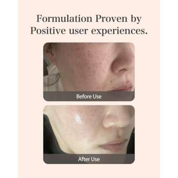 Mastina Mastic Ampoule (Dropper Type, 0.5fl oz) - Dark Spot Remover Face Serum for Even Skin Tone. Fermented Mastic Gum.