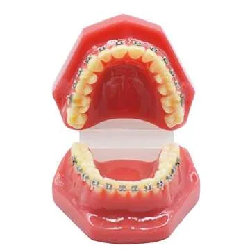 Dental Orthodontic Metal Bracket with Typodont Teeth Model for Training and Education