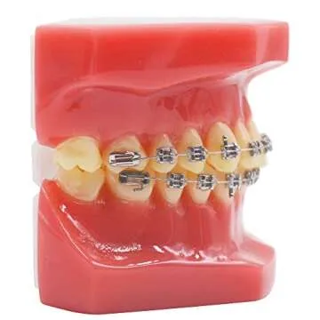 Authentic Dental Orthodontic Metal Bracket Typodont Model