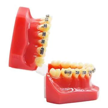 Authentic Dental Orthodontic Metal Bracket Typodont Model