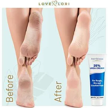 Urea Cream 20% Extra Moisturizing For Severe Dry Cracked Skin On Feet, Hands & Elbows - Keratolytic Emollient For Intensive Fast Healing 4 oz.