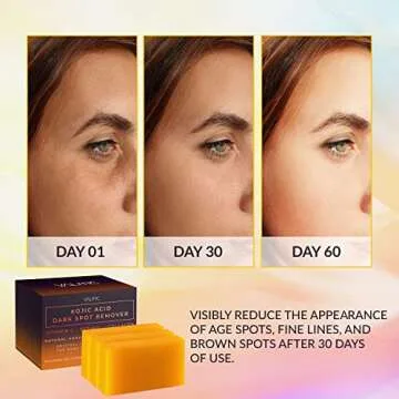 VALITIC Kojic Acid Dark Spot Remover Soap Bars with Vitamin C, Retinol, Collagen, Turmeric - Origina...